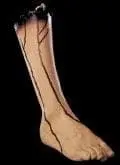Morris "Severed Right Leg" Bloody Body Part Halloween Prop 3 Morris "Severed Right Leg" Bloody Body Part Halloween Prop